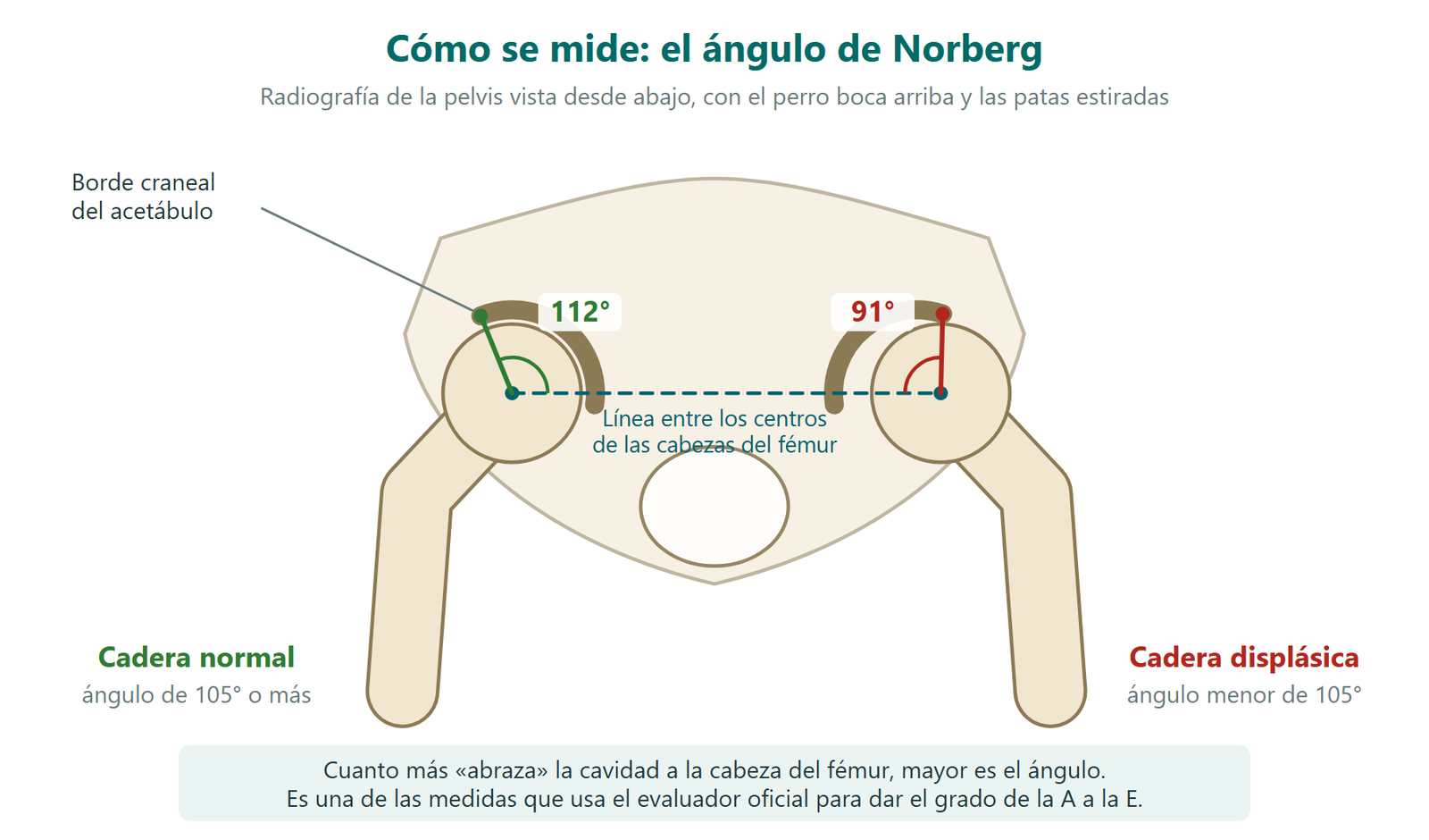 Esquema del ángulo de Norberg en una radiografía de pelvis: 112 grados en la cadera normal y 91 grados en la cadera displásica